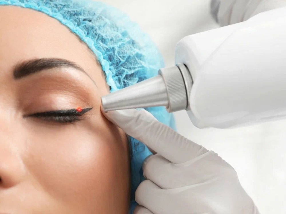 Permanent Makeup and Removal about